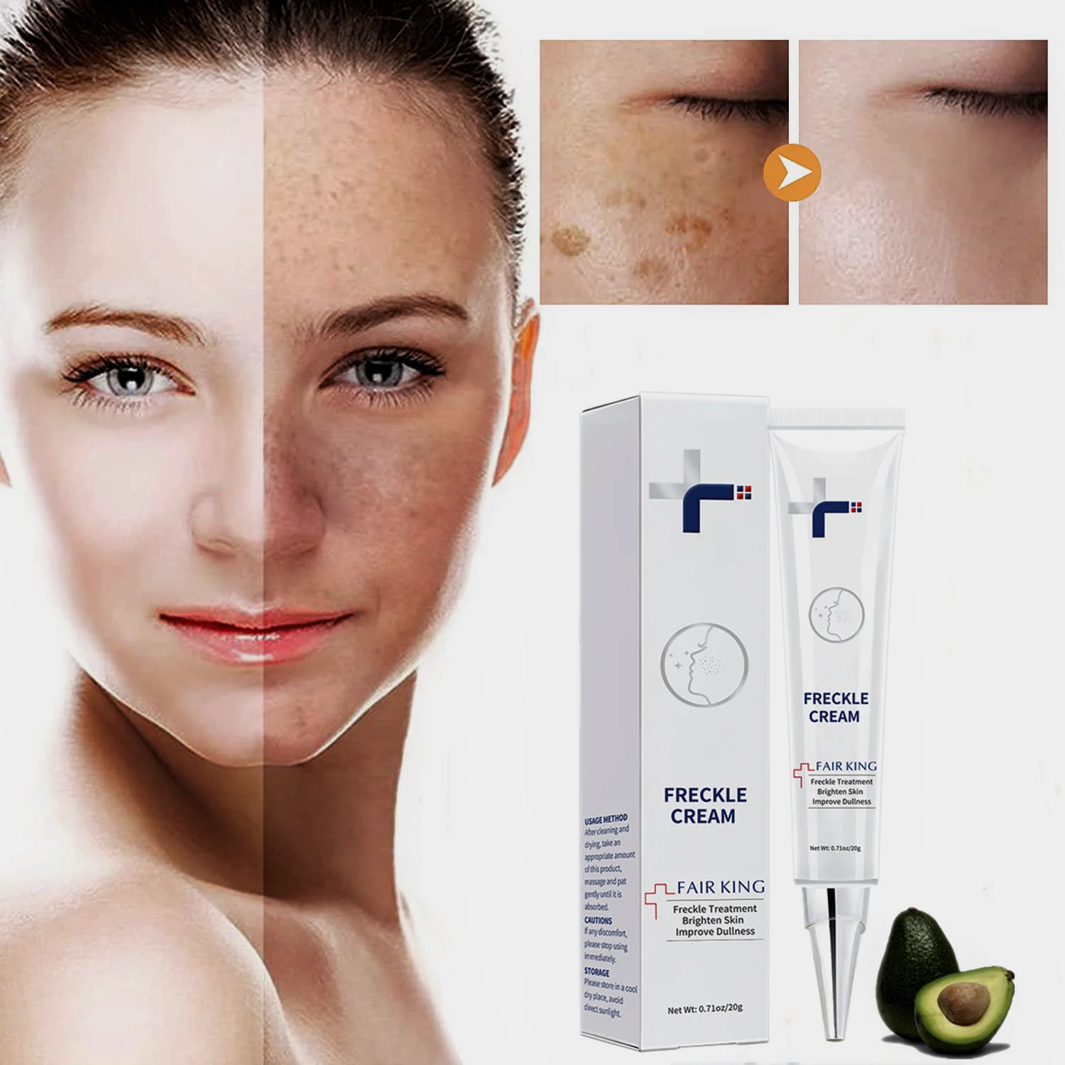 

Whitening Freckle Cream Remove Melasma Cream Remove Dark Spots Melanin Melasma Remover Brighten Skin Anti-Aging Moisturizing Gel