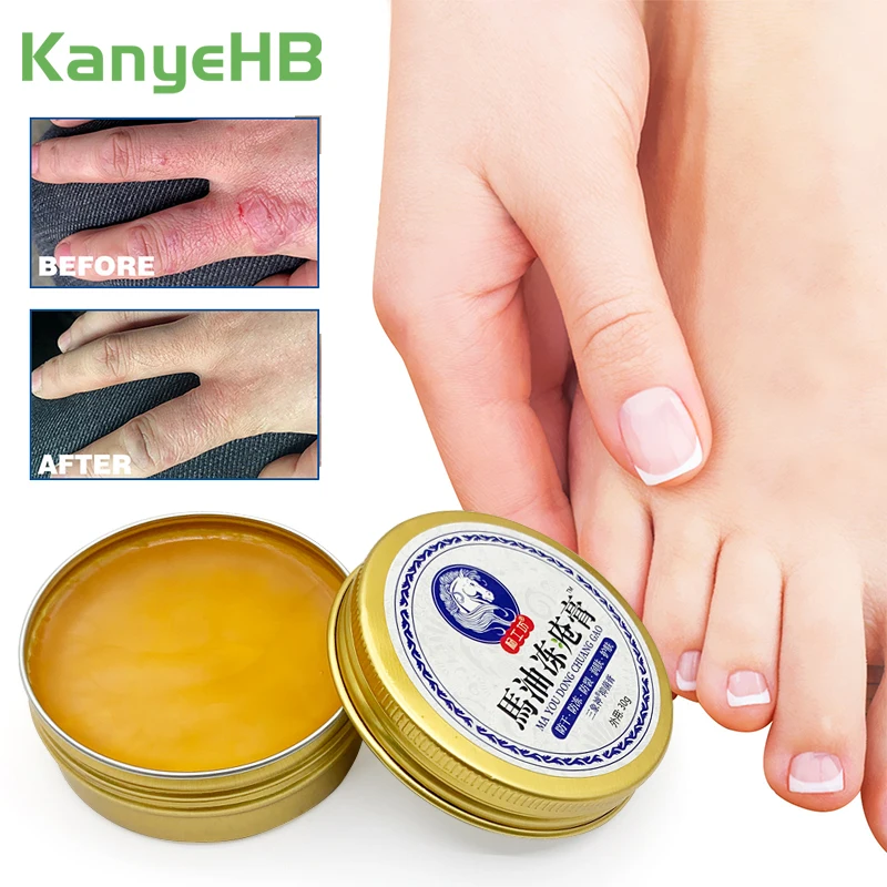 

1pc Chilblain Cream Prevent Skin Cracked Anti-drying Anti-freeze Heel Feet Moisturizing Relieve Skin Peeling Repair Cream S048