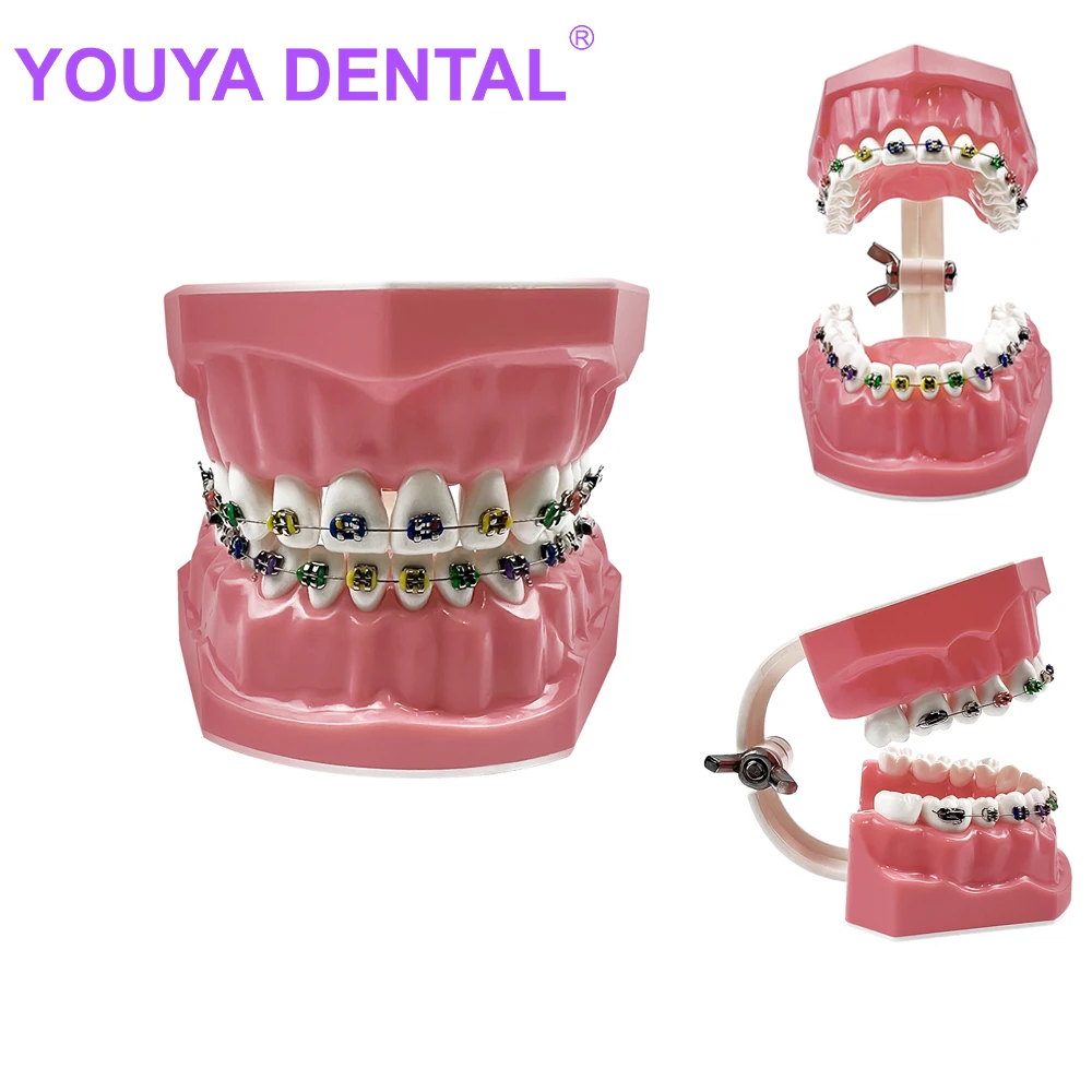 

Ортодонтическая модель зубов с Полноразмерным металлическим кронштейном, модель челюсти Typondont, модель стоматологической ортодонтической терапии для обучения