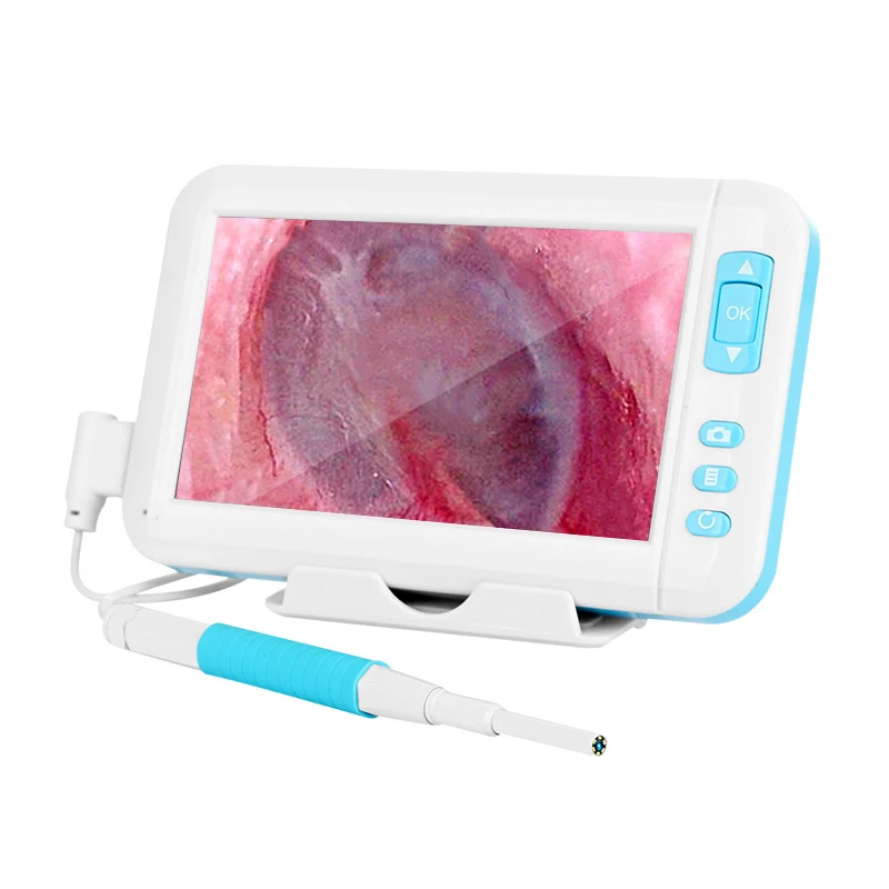 

Отоскоп для очистки ушей, камера-эндоскоп HD1080P, 3,9 мм, 4,3 дюйма, HD-экран, отоскоп, цифровой ушной монитор, наушники