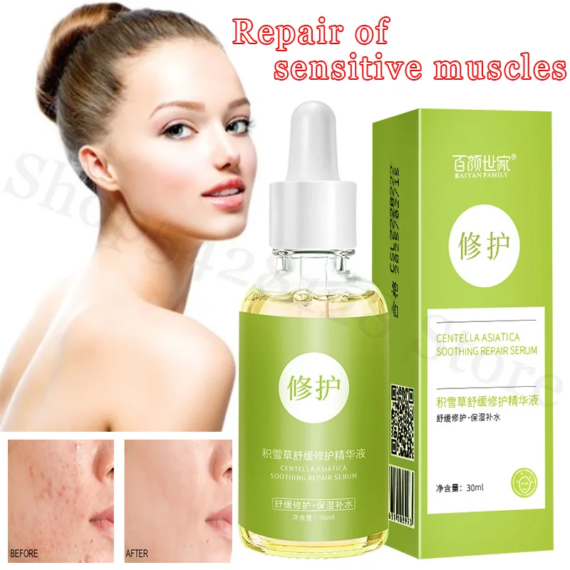 

Centella Asiais Repair Stock Solution To Shrink Pores and Fine Skin Effectively Improve Sensitive Muscle Soothing Repair Essence