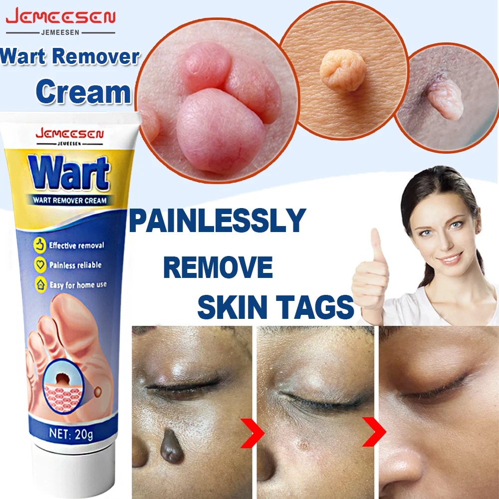 

Jemeesen Wart Remover Cream Clean Painless Mole Skin Dark Spot Warts Remover Face Wart Tag Treatment Men Women Serum Cream
