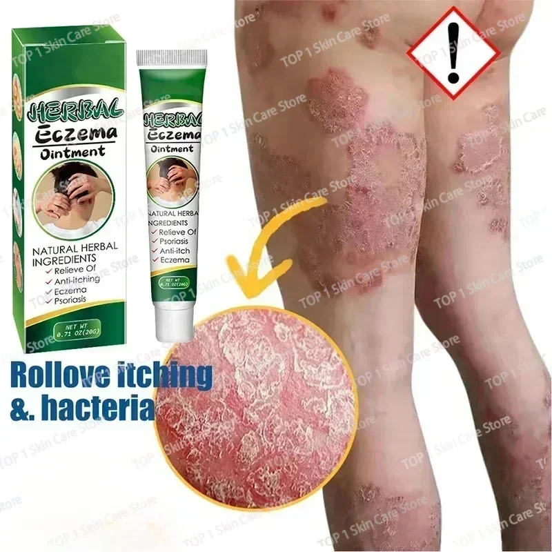 Китайская Антибактериальная мазь на основе лекарственных трав при псориазе Eczma