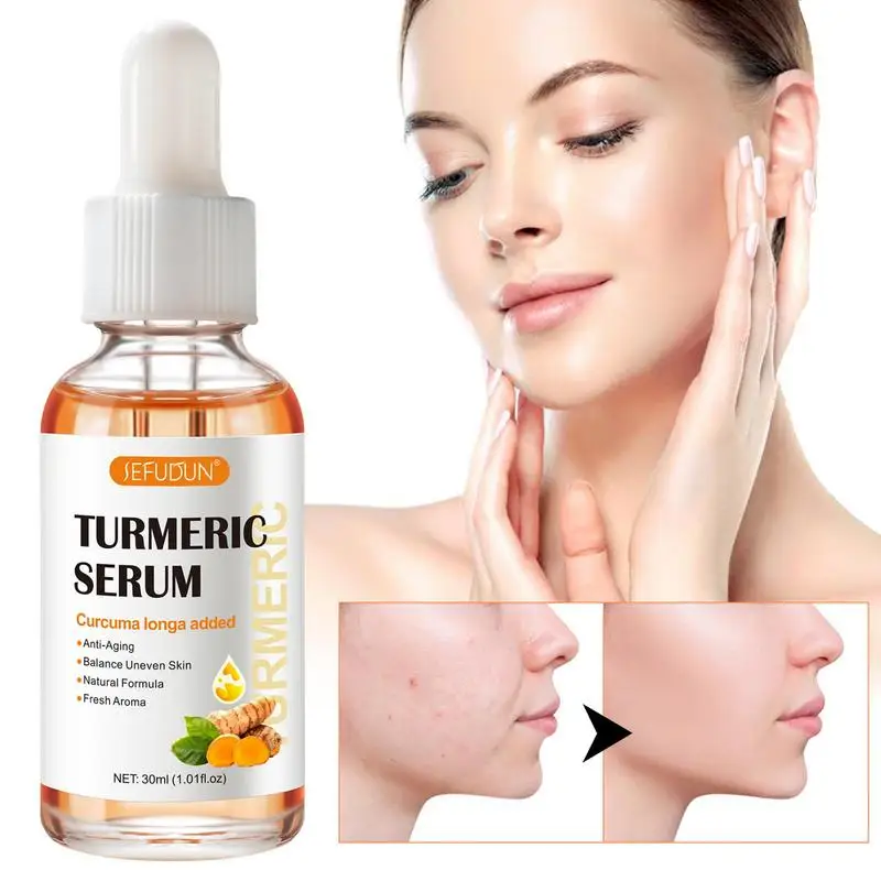 

Turmeric Facial Essence Face Fluid Essence With Turmeric Extract Nourishing And Plumping Face Essence Liquid Hydrates Dull & Dry