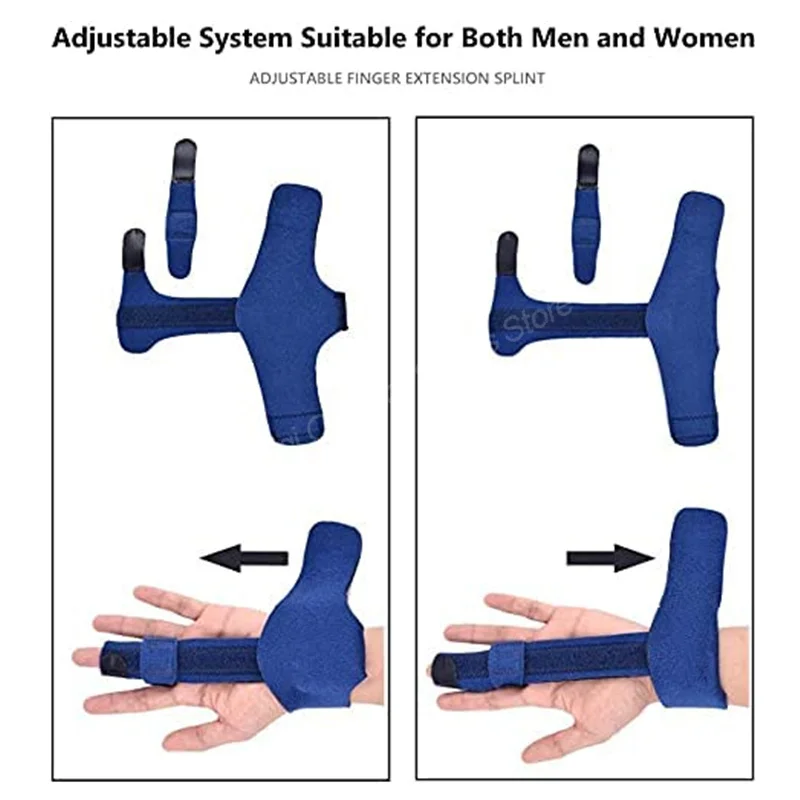1 шт. алюминиевый корректор для пальцев при артрите