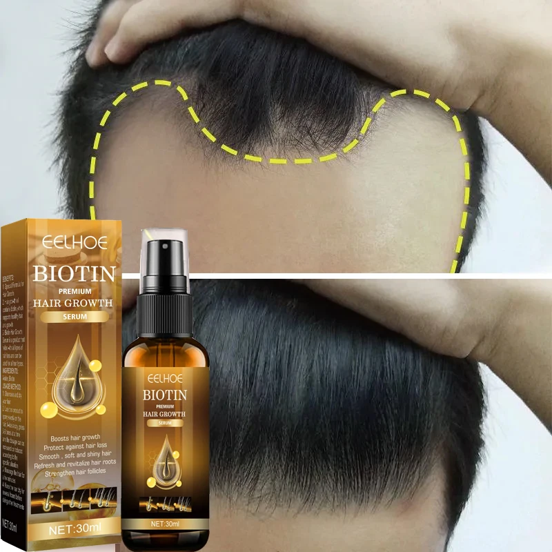 

Hair Growth Serum Fast Growing Anti Hair Loss Treatment Essence Prevent Baldness Scalp Repair Nourishing Hair Care Oil Products