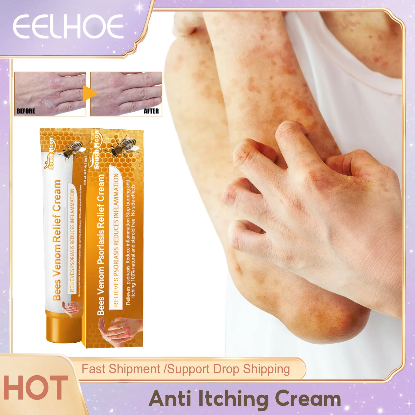 

Psoriasis Antibacterial Cream Inhibit Dermatitis Eczema Removal Anti Itch Rash Hand Foot Tinea Treatment Fungus Repair Ointment