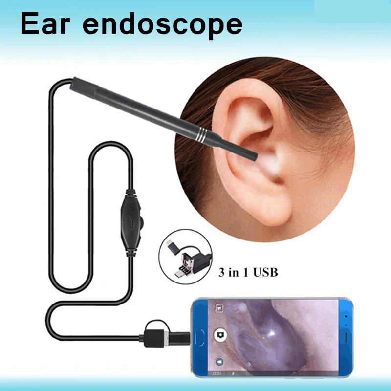 3 In 1 Endoscope Camera Otoscope, Medical Toothpick Ear Cleaning Kit, Ear Wax Removal Tool Otoscope Ear Wax Removal Tool