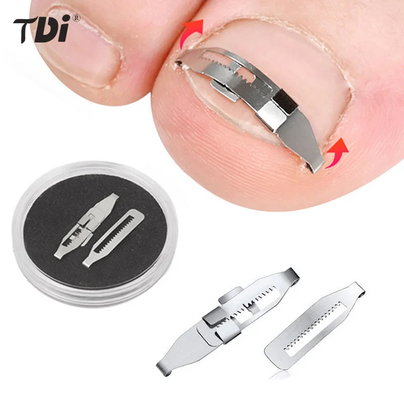 

Ingrown Toe nail Corrector Tools Pedicure Recover Embed Toe Nail Treatment Professional Toenail Correction Foot Care Tool