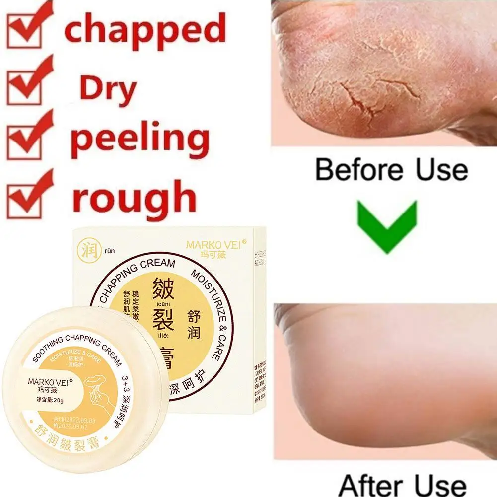 

20g Heel Balm For Dry Cracked Feet Cracked Skin Repair Soothing Chapping Cream Removal Dead Skin Hand Feet Care Moisturizing Gel
