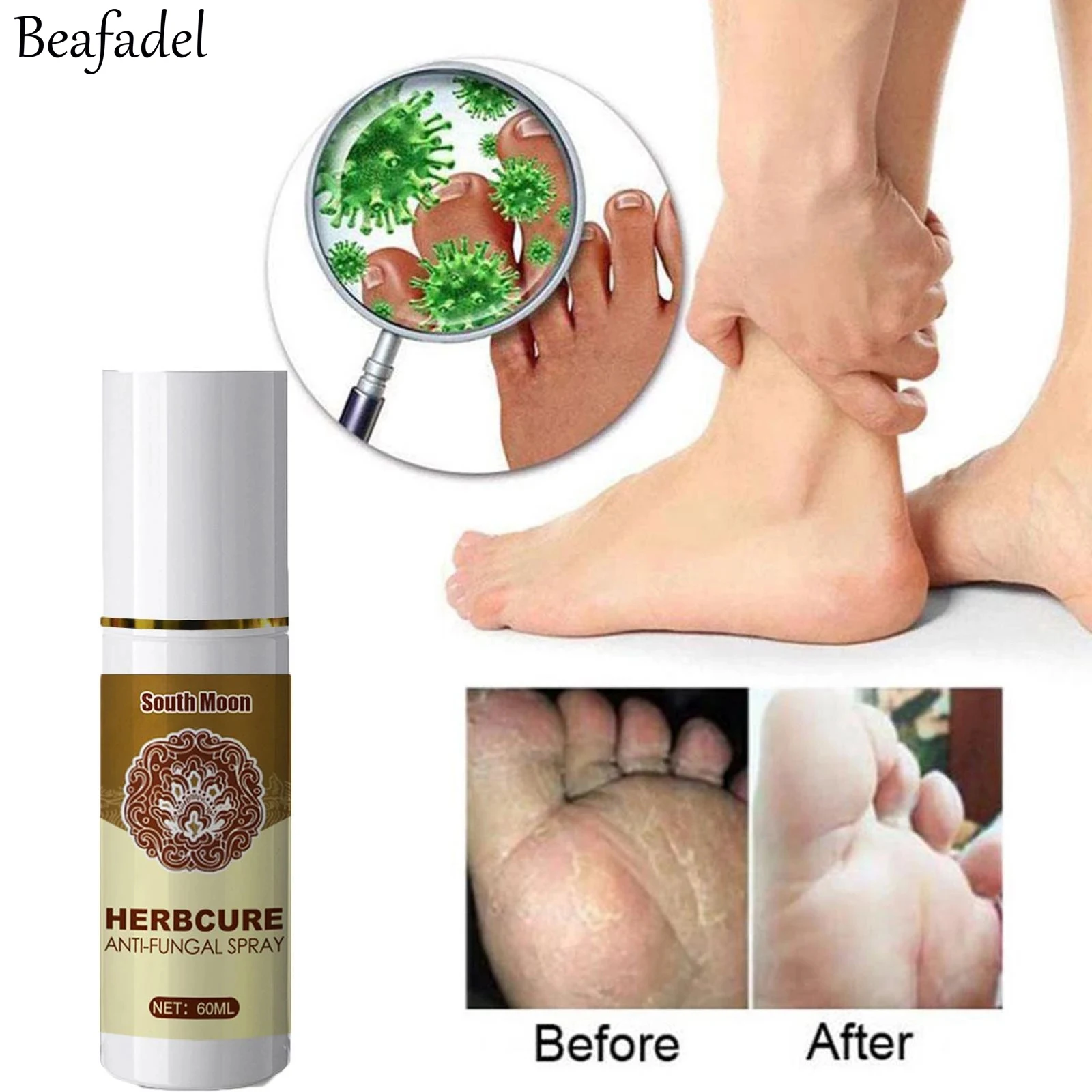 

60ml Fungal Combat Feet Spray Foot Sterilize Spray Herbal Anti-fungal Infection Toe Treatment Onychomycosis Anti Bacterial