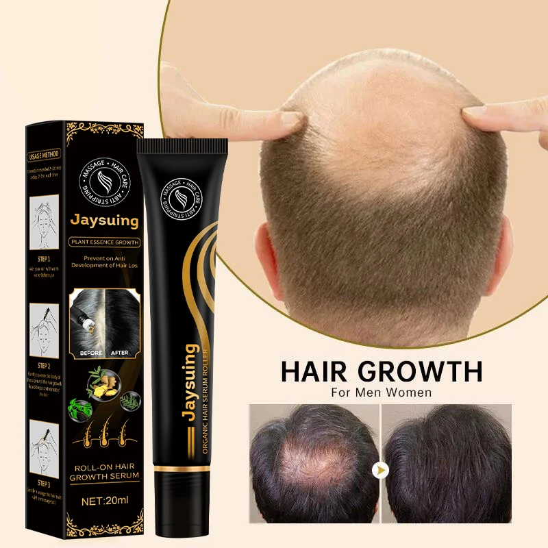 

Ginger Hair Growth Serum Prevent Hair Dry Frizzy Anti Hair Loss Treatment Essence Roller Massage Scalp Care Fast Growth Products