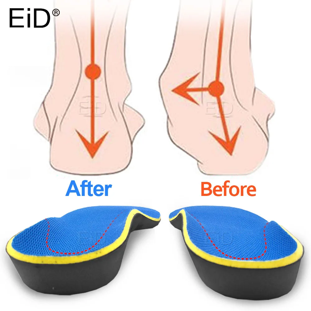 EiD 3D Orthotic insoles Flat feet Arch support Orthopedic inserts Plantar Fasciitis Feet Pain Pronation for Men Women Unisex