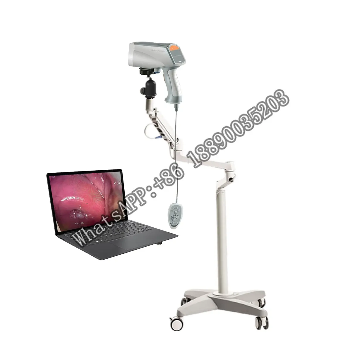 

CE Medical 0.08 million SD Digital Endoscope Camera Imaging Colposcope examination colposcope digital imaging system