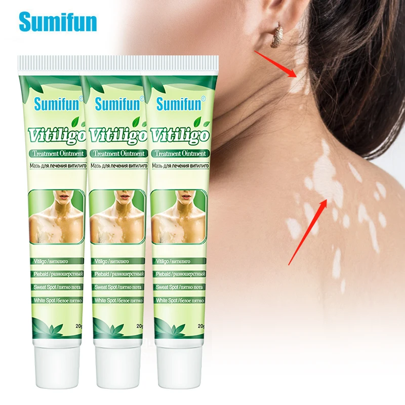 

1/2/3Pcs Sumifun Vitiligo Treatment Cream White Spot Localized Mycosis Antibacterial Ointment Leukoplakia Psoriasis Skin Care