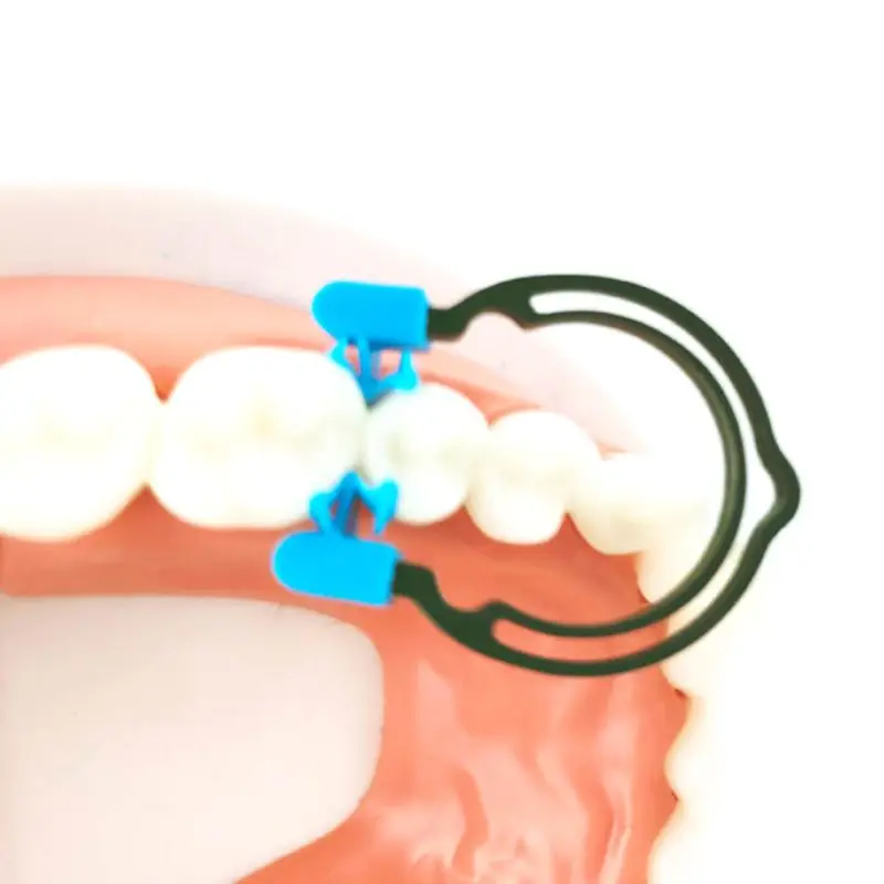 Рисунок 3 - Сменные зубы типа A/B