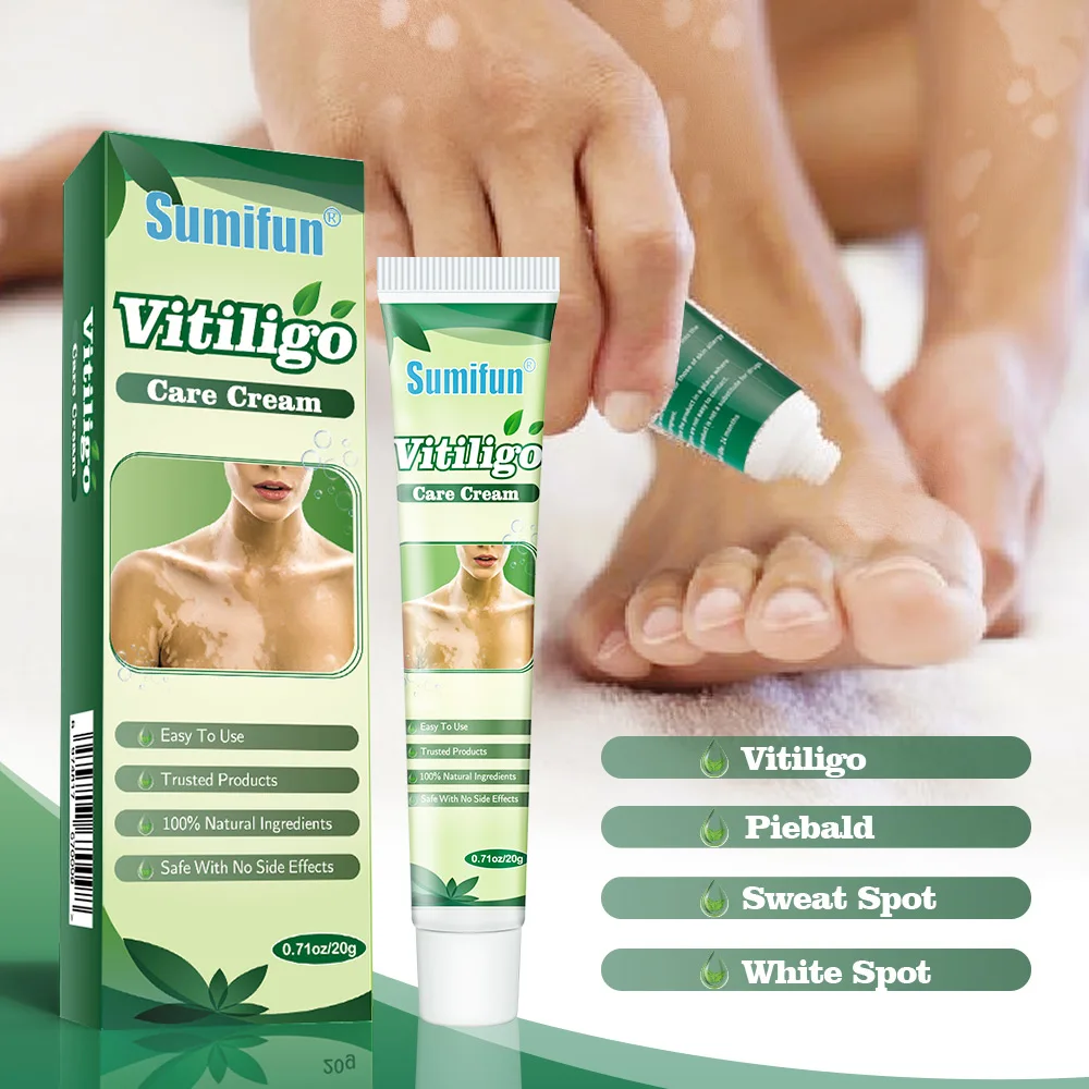 Лечебный крем Sumifun для Vitiligo антибактериальная мазь с белыми пятнами