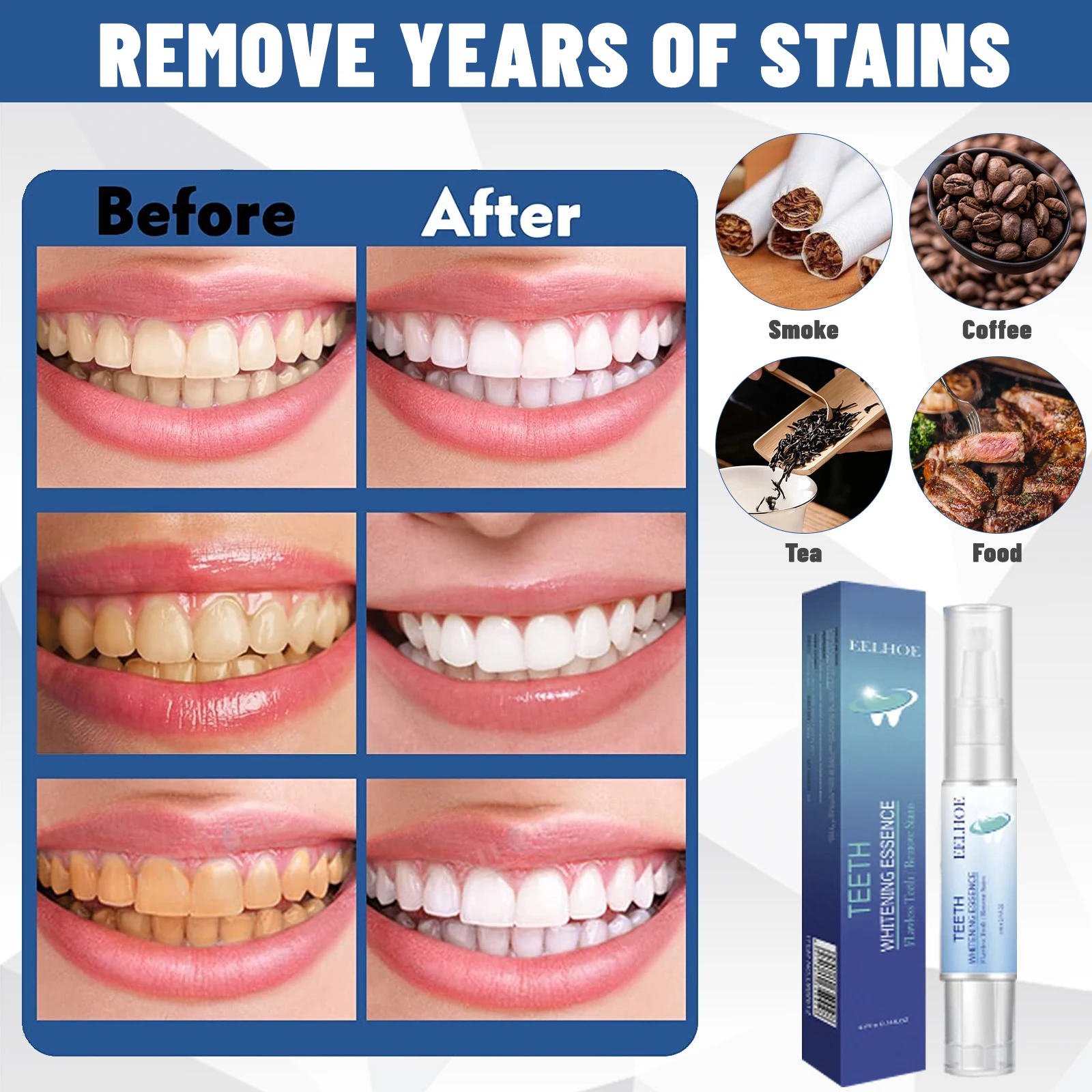 

New Teeth Whitening Pen Tooth Gel Whitener Bleach Remove Stains Instant Smile Teeth Whitening Kit Cleaning Serum Beauty Health