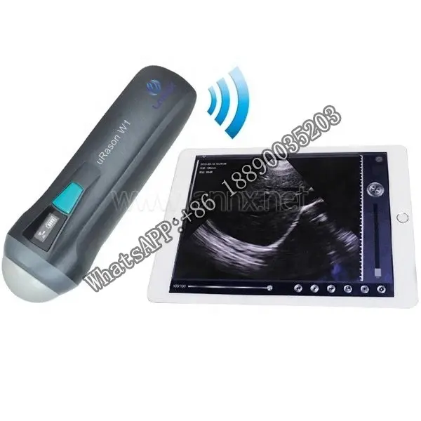 

LANNX uRason W1, оптовая продажа, ручные зонды для беременных, Wi-Fi, все в одном, цветной зонд, сканер