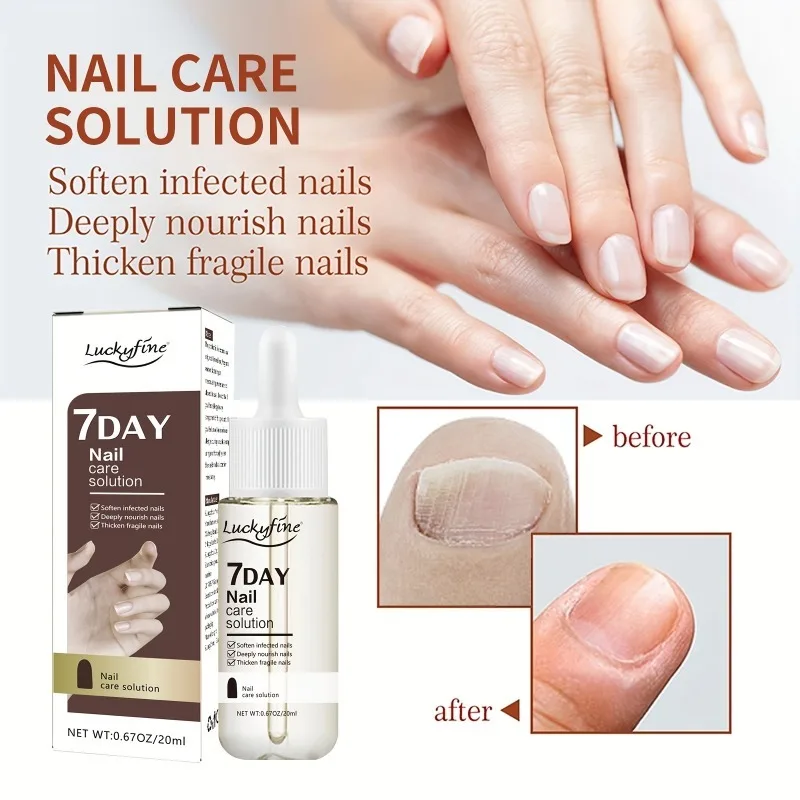 

Toenail Fungus Treatment,Extra Strength Nail Repair Solution for Fingers,Toenail Repair Solution for Thickened Ingrow Nails