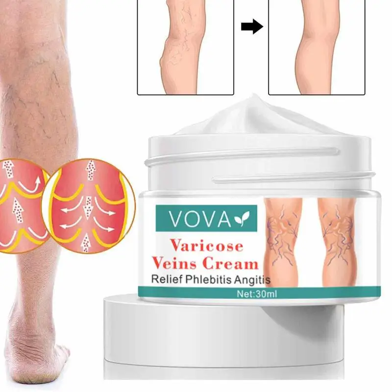 

Увлажняющий и нежный крем для восстановления вен, 30 мл