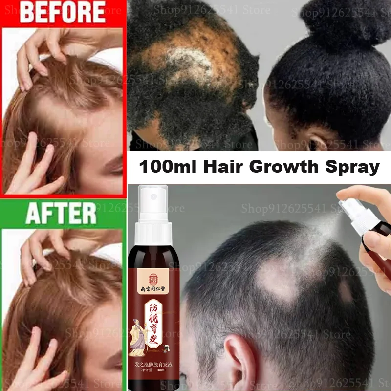

100ML Ginseng Ginger Anti-hair Loss Treatment Herbal Polygonum Multiflorum Hair Growth Spray Repairs Damage Restore Soft Hair