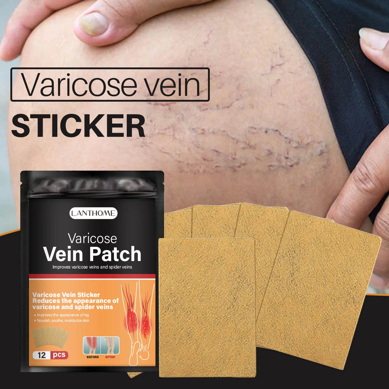 

12Pcs Varicose Vein Patch Leg Sore Swelling Relief Plaster Patch Leg Varicose Venous Sticker Medical Plaster Feet Care Products