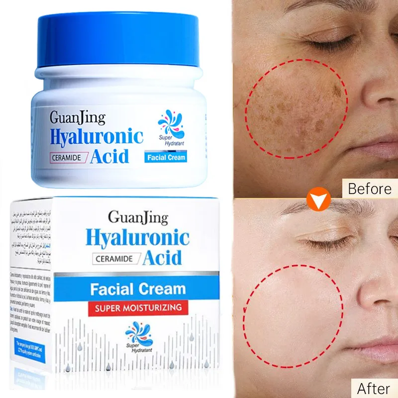 

Ceramide&Hyaluronic Acid for Face Cream Pigments Dark Spots Removal Whitening Facial Cream Lightening Skin Care Products