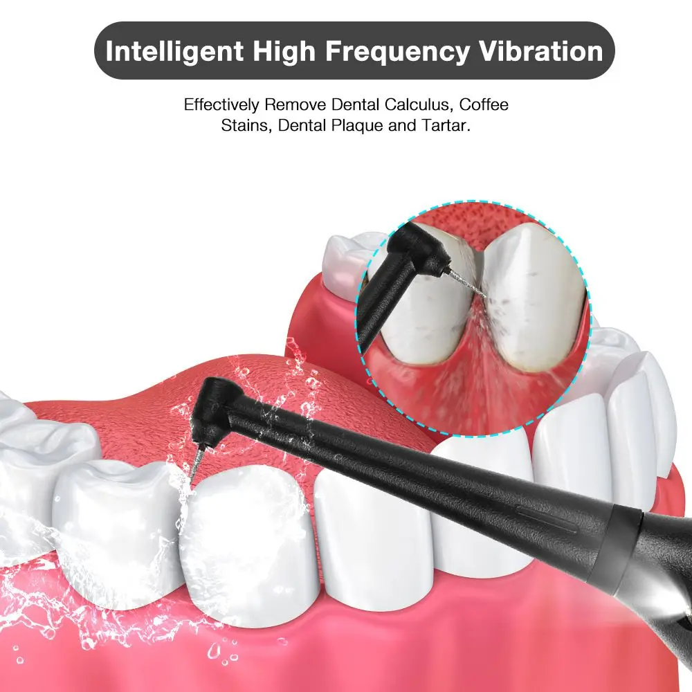 

Stains Clean High Frequency Oral Care Tartar Remover Dental Stone Scaler Tooth Whitening Tool Electric Teeth Cleaner