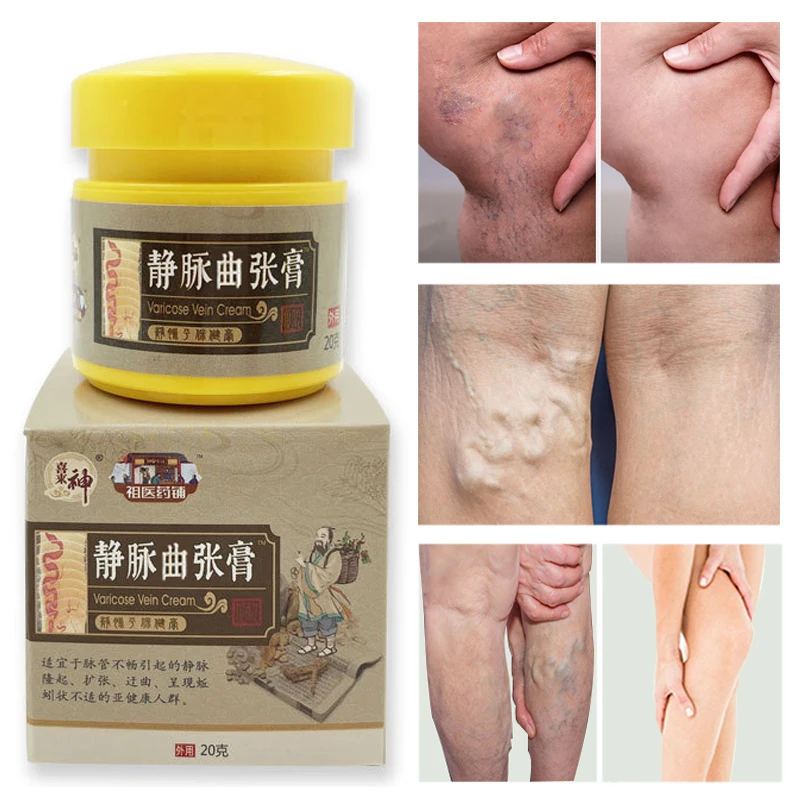 20g Varicose Vein Repair Cream Massage Soothes Puffiness Vasculitis Itching Mineral Vegetable Oil Body Private Part Skin Care