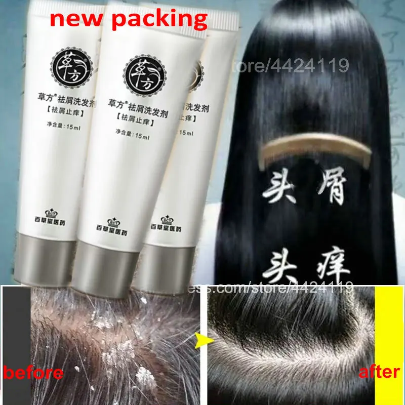 

Новый шампунь для ухода за волосами против перхоти сильный антипругический лечение волос Продукты для волос дерматит против перхоти Восст...