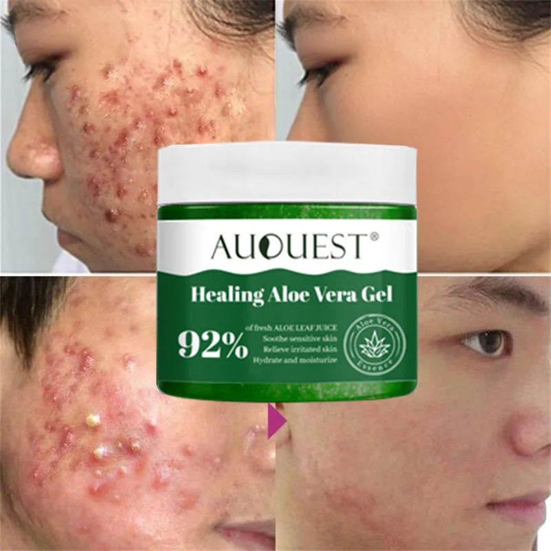 

50gAloe Vera Gel Fade Acne Mark Moisturize Cream After Sun Repair Acne Treatment Improve Red Dry Peeling Relief Psoriasis Eczema