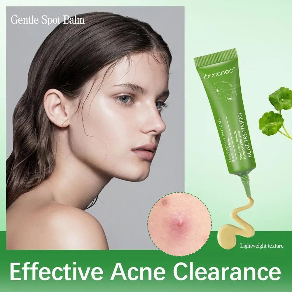 

15g Herbal Acne Cream Fades Acne Marks Spot Removal For Oil Control Acne Gel Shrink Pores Soothing Skin Care G5F1