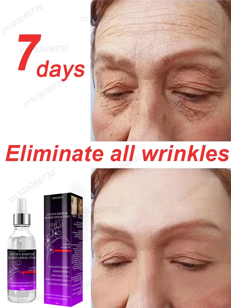 

Эффективная Сыворотка для лица против старения и морщин для удаления морщин и тонких линий вокруг глаз