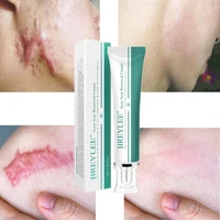 acne scar removal cream pigmentation corrector beauty skin care stretch marks treatment pigment correction whitening products