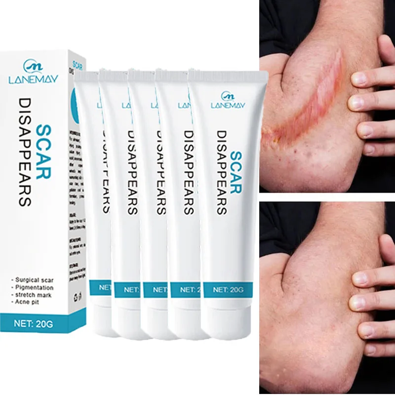 

Scar Removal Cream Repair Stretch Marks Burn Acne Surgical Acne Scar Ointment Herbal Treatment Gel Whitening Beauty Health Care