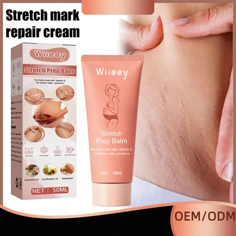 

40 мл предупреждение беременности Послеродовое восстановление Крем Для Удаления растяжек для растяжения кожи живота