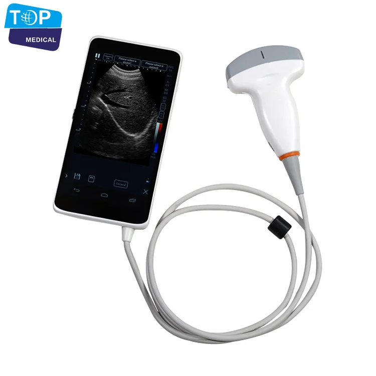 TOP-A1026 Wifi Mini Ultrasound Machine Price Cheapest Portable Ultrasonic Diagnosis System CE,ISO Approved Color Doppler
