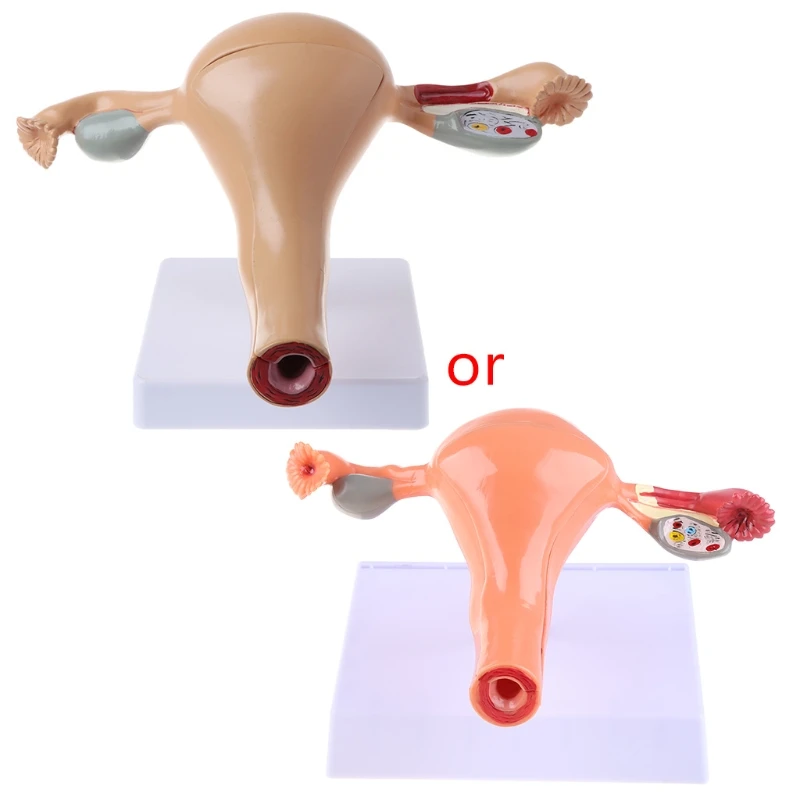 

2022 New Human Pathological Uterus Ovary Model Anatomical Anatomy Disease Pathology Medical Lesion For Teaching