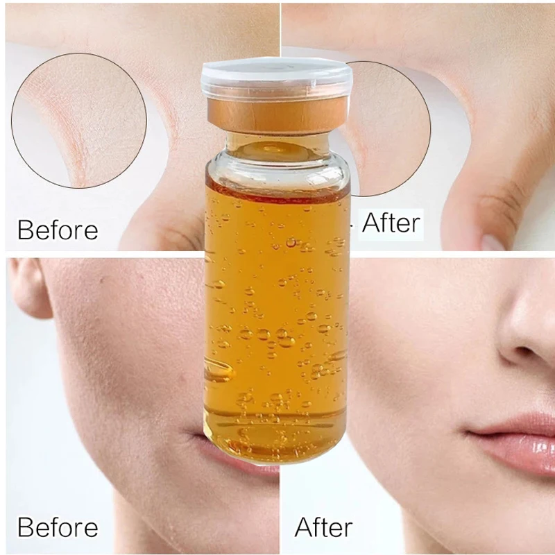 

Astaxanthin Hyaluronic Acid Essence Set Hydrating Anti-aging Anti-wrinkle Face Treatment Serum Shrink Pore Face Serum Skin Care