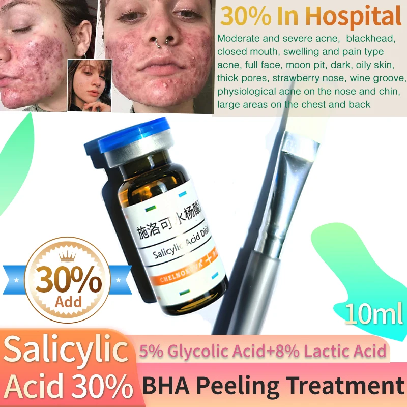 BHA acido salicilico 30% spazzola per il viso Peeling acido trattamento Anti Acne Peeling Peeling chimico a casa Papule causa acido sul petto posteriore