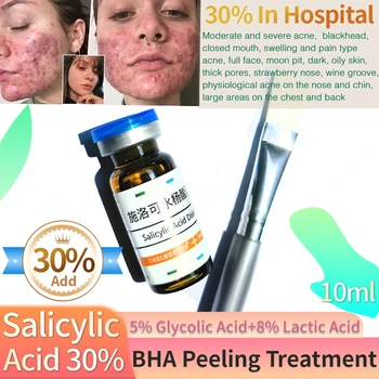 O ácido salicílico de bha 30% escova facial ácido casca anti acne tratamento peeling casca química em casa papule causa ácido no peito traseiro