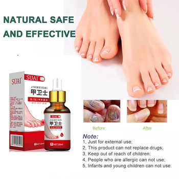 Nail Fungal Treatment Serum Onychomycosis Paronychia Anti Infection Toe Fungus Hand Foot Removal Repair Gel Care Beauty Health 5
