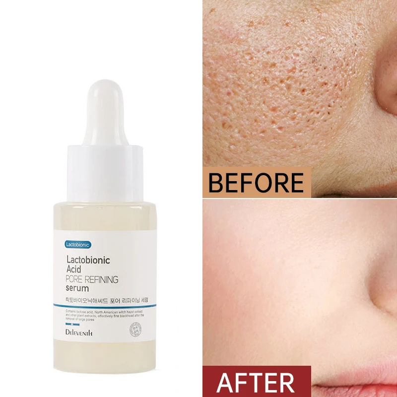 

Lactobionic Acid Shrink Pores Face Serum Firming Skin Whitening Nourish Blackhead Remove Facial Essence Korean Skin Care Product