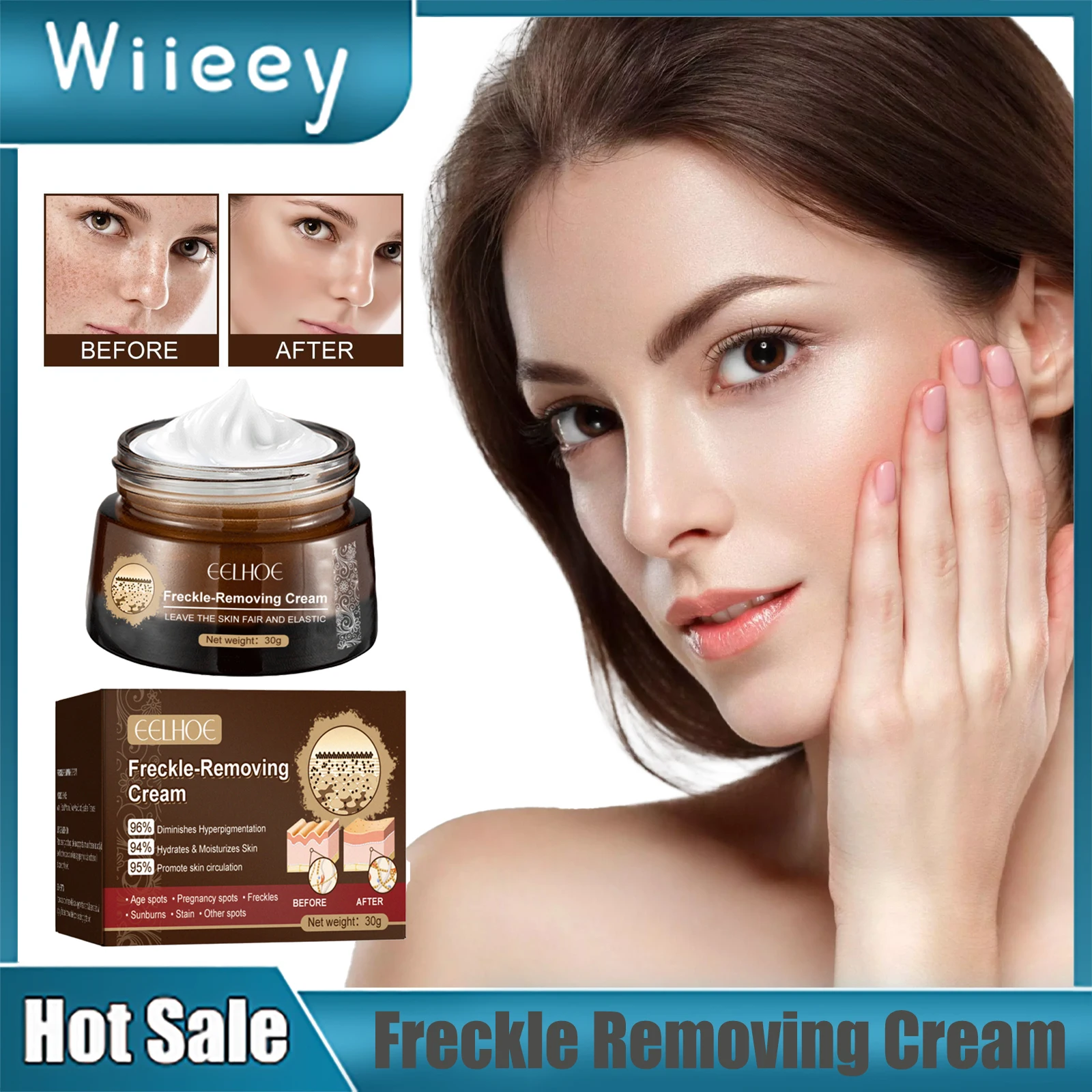 

Freckle Removing Cream Whitening Remove Dark Age Spots Lightening Melasma Pigmentation Corrector Brighten Blemish Removal Cream