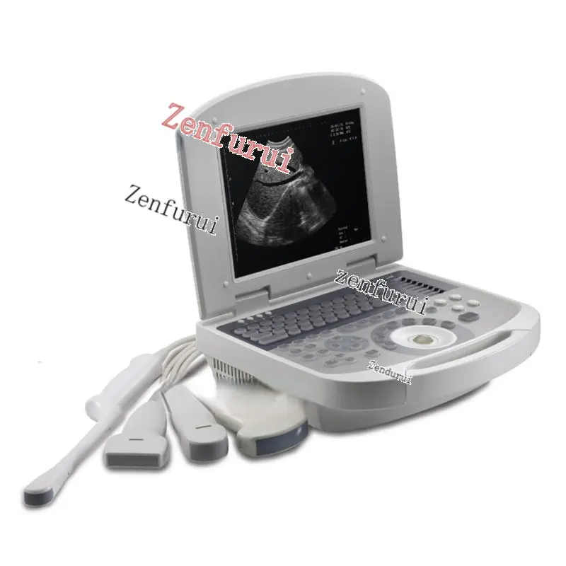 

Профессиональное оборудование, ветеринарный диагностический блок, ноутбук, ультразвуковой сканер, портативная ультразвуковая машина