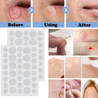 36pcs acne pimple patch hydrocolloid sticker acne treatment removal waterproof black head remover tool facial mask skin care