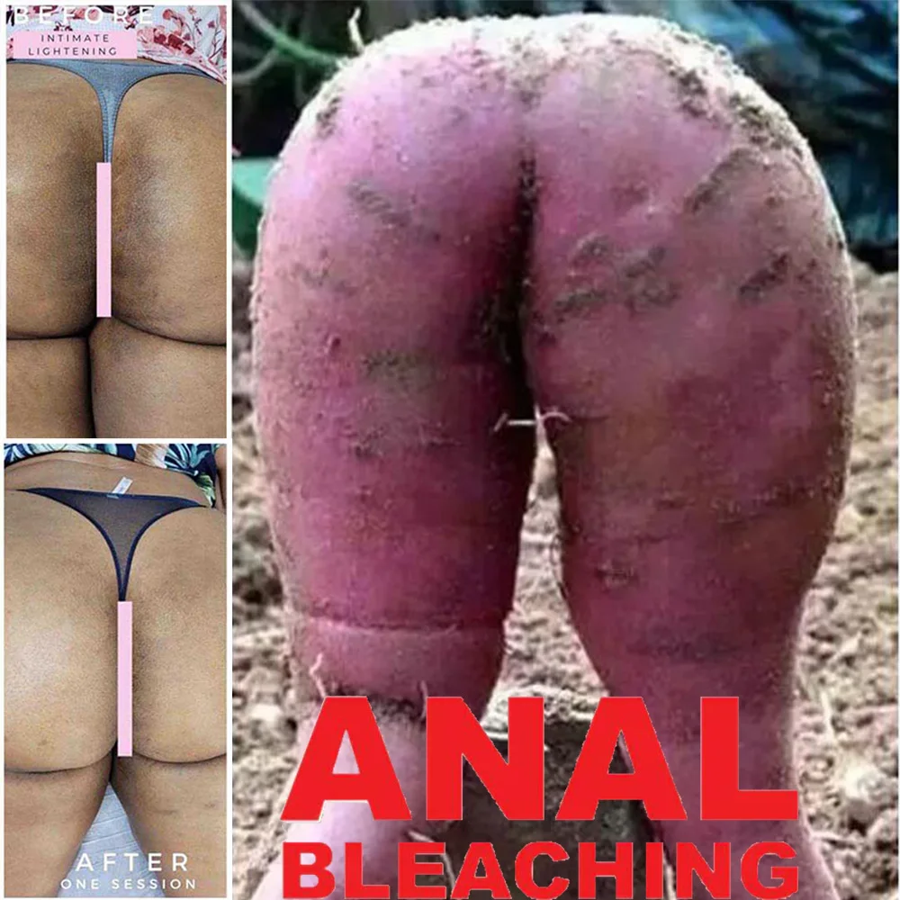 

Africa Brick Lighten DARK VAGINAL AREA Naturally Underarm and Private Parts Whitening Inner Thighs Butts Anal Bleaching Safely