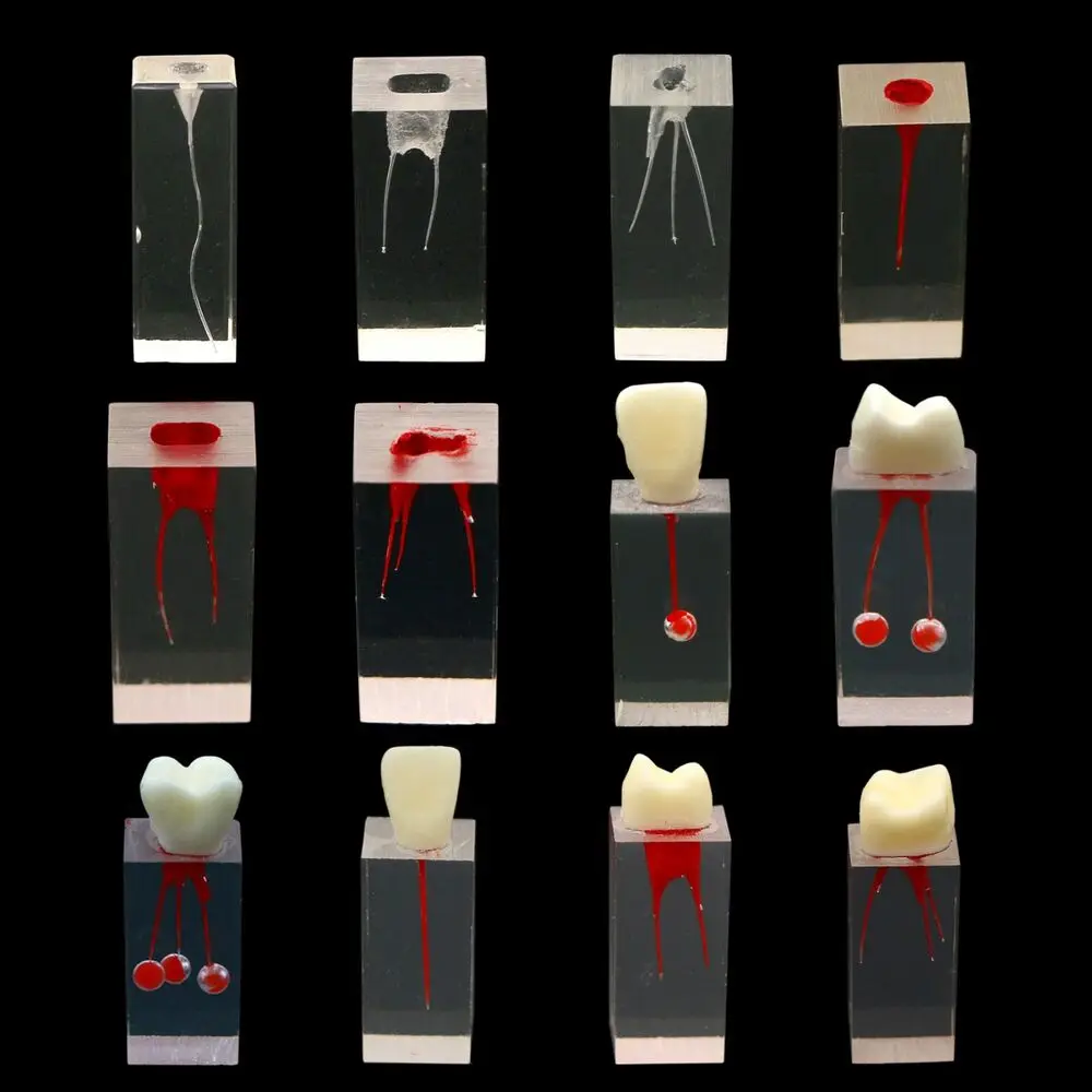 

10 шт., Стоматологическая модель корневого канала