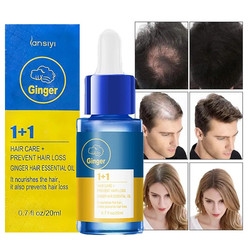 

Уход За Волосами Эфирные масла для роста волос эссенция оригинальная Подлинная 100% жидкость для выпадения волос здоровое средство красоты